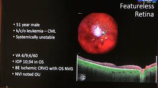 AIOC 2026   IC168   Controversies in Retinal Imaging Answer the Unanswered