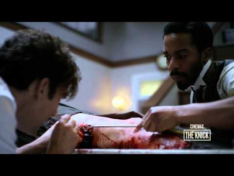 The Knick Season 1 (Featurette 'Surgery 101')