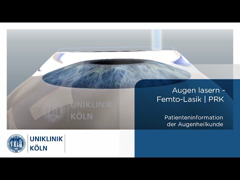 Augen lasern (Femto-Lasik | PRK)