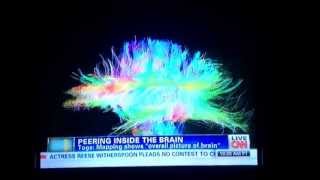 UCLA Brain Mapping Research