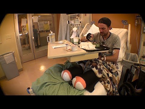 Colorado Climber Who Lost Legs to Frostbite Recounts Life-Changing Night
