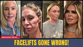12 Real Housewives’ Plastic Surgery Fails | Before & After 2026