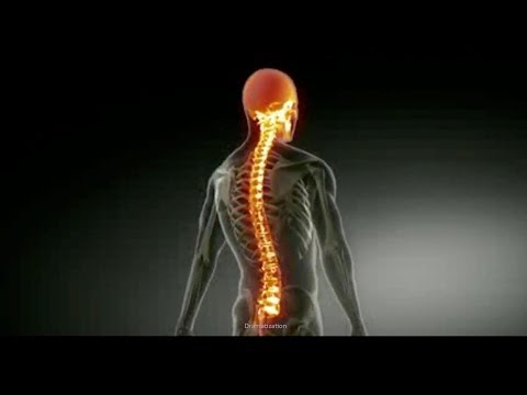 Watch lagu Images Videos Icd 10 Code For Cerebral Palsy Quadriplegic, Watch Images Icd 10 Code For Cerebral Palsy Quadriplegic free Watch, Watch Images Icd 10 Code For Cerebral Palsy Quadriplegic