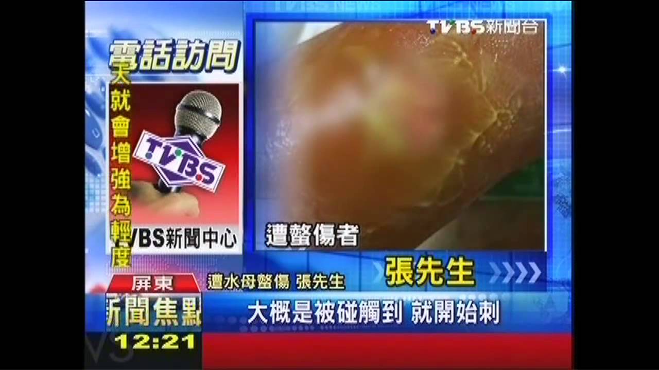水母大軍！墾丁戲水遭螫　遊客哇哇叫