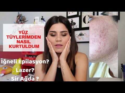 download lagu mp3 mp4 Ineli Epilasyon Ingilizcesi, download lagu Ineli Epilasyon Ingilizcesi gratis, unduh video klip Ineli Epilasyon Ingilizcesi