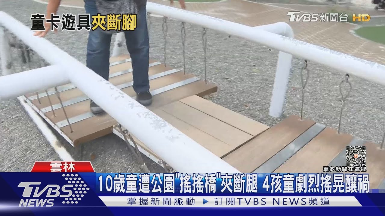 10歲童遭公園「搖搖橋」夾斷腿 4孩童劇烈搖晃釀禍