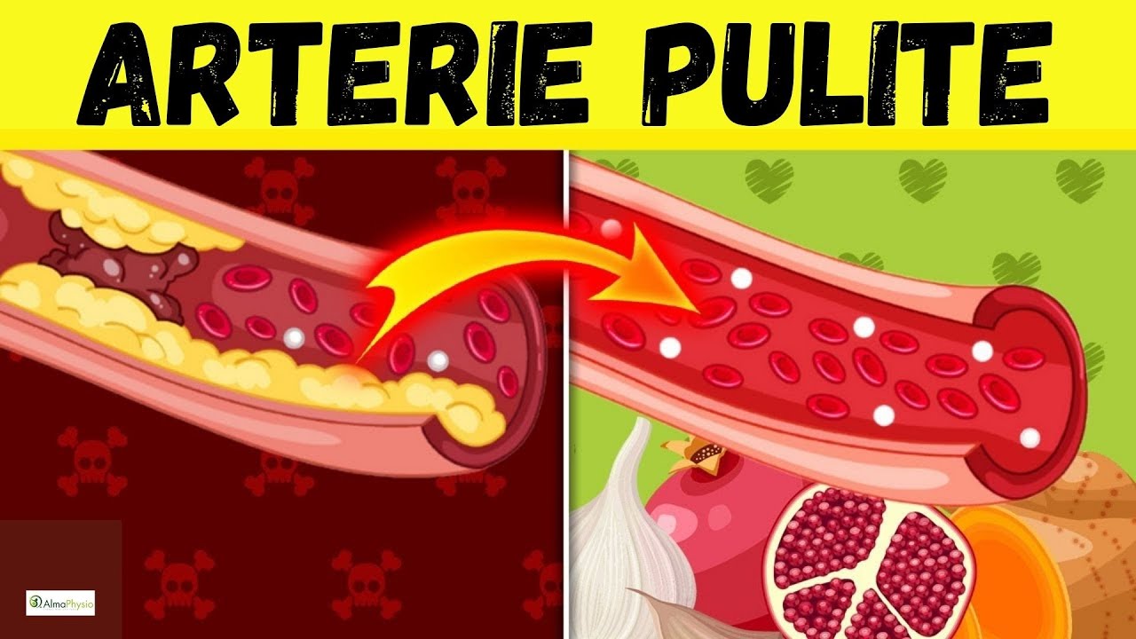 ♥️ Questi 10 ALIMENTI puliscono le ARTERIE e SALVANO il tuo CUORE 🫀