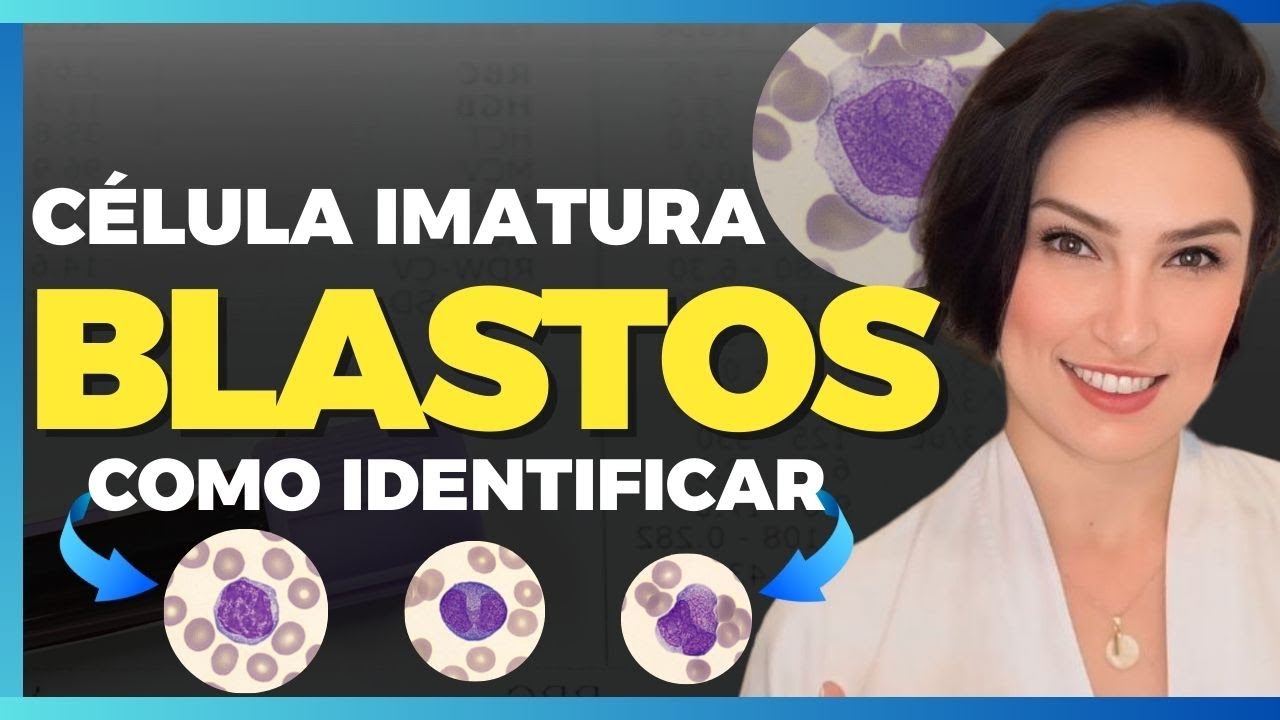 Como identificar BLASTOS no hemograma completo  AULA AO VIVO - Biomedicina