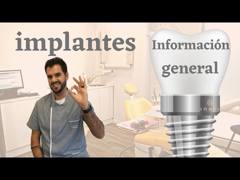 Información general sobre implantes.