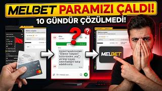 Melbet Para Yatırma Sorunu! | Melbet sitesi parama çöktü 4.video (Çözüm olmadı 1