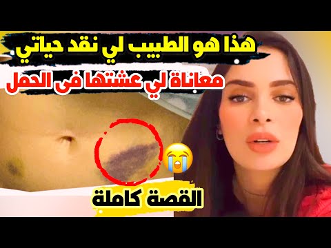 صفاء حبيركو : هادي هي معاناة لي عشتها فى الحمل و في الولادة القيصرية و هذا هو الطبيب لي نقد حياتي😪