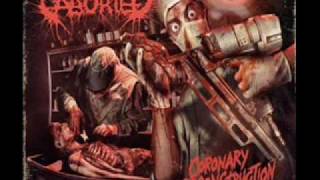 Download lagu aborted - coronary reconstruction mp3