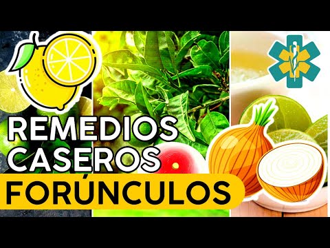 Effective home remedies for boils | How to cure boils