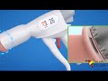 How Is Adult Circumcision Done Using Stapler Circumcision Technique