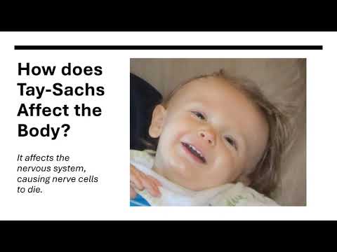 Tay Sachs Genetic Disorder Project HEXA Hope - Daniel S Jacob M, and Smith B