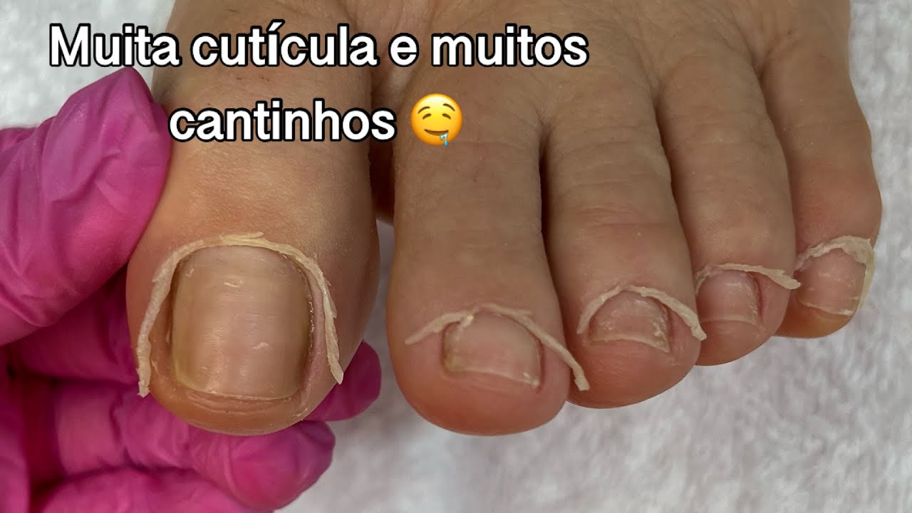 PEDICURE | TRANSFORMAÇÃO