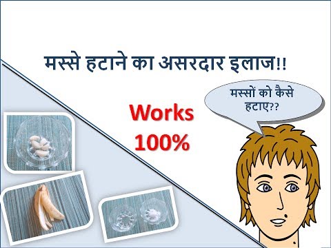 Masso ka ilaj - मस्से हटाने का उपाय Hindi | WORKS 100% Natural Remedy Video