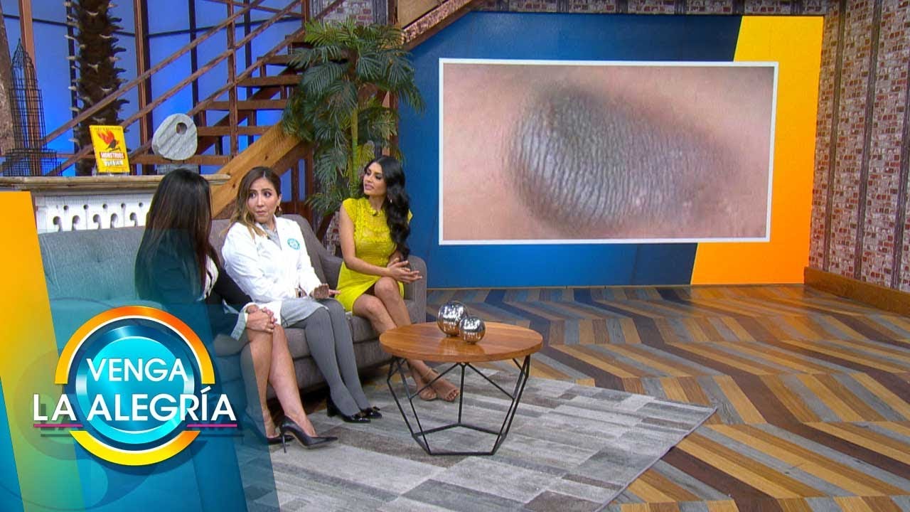 Watch ¿Codos y axilas negras Checa qué puedes hacer para eliminarlos y lucir increíble.| Venga La Alegría Now ¿Codos y axilas negras Checa qué puedes hacer para eliminarlos y lucir increíble.| Venga La Alegría