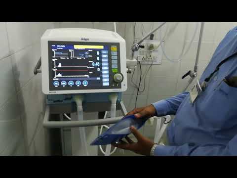 savina 300 salect Ventilator