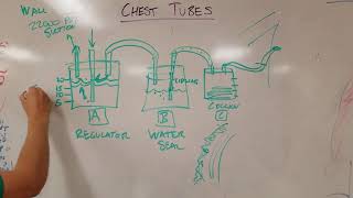 How Chest Tubes Work (Tube Thoracostomies)