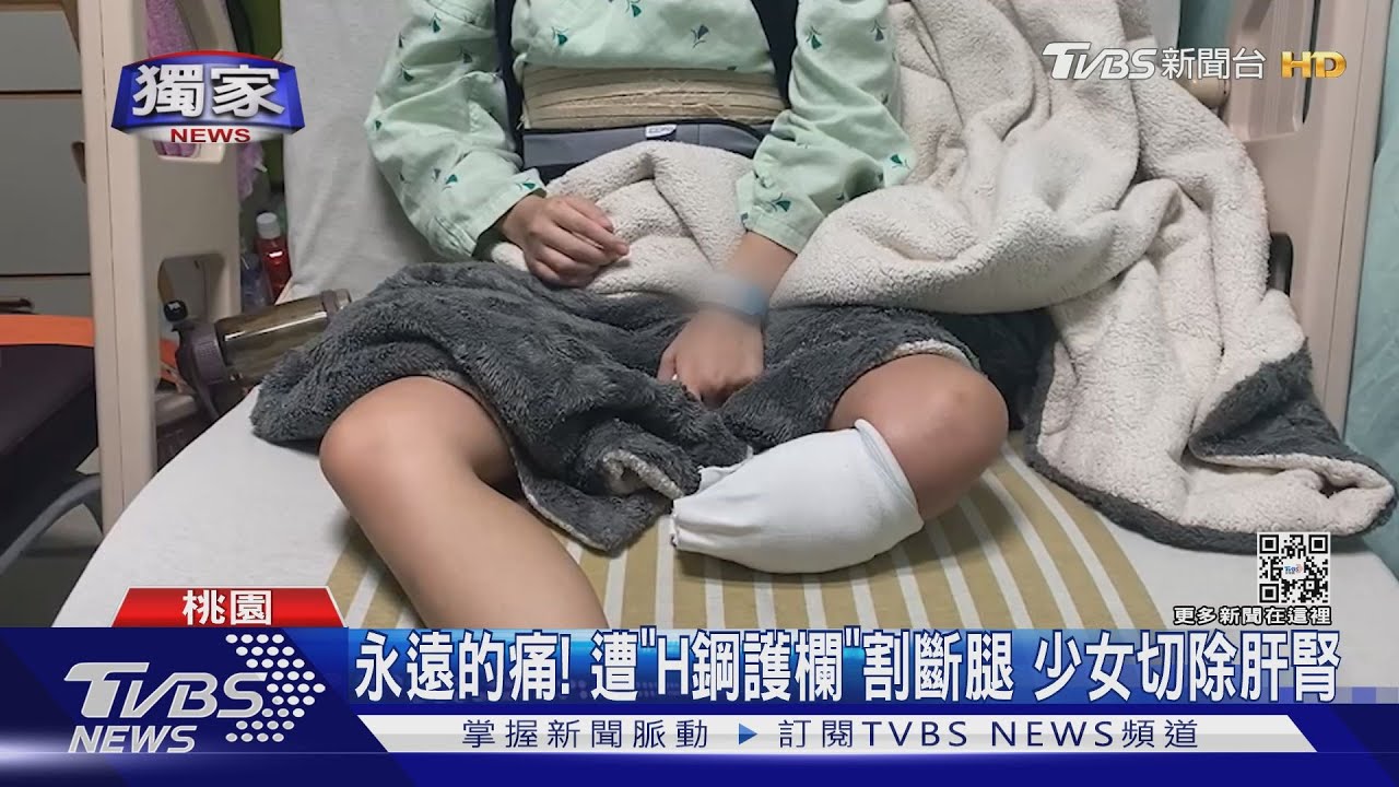 永遠的痛！遭「H鋼護欄」割斷腿　少女切除肝腎