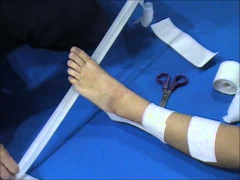 comment soigner au plus vite une entorse