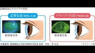 ドライアイ　目の病気