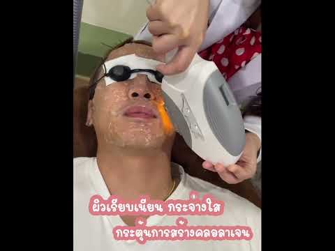 เคล็ดลับหน้าใสด้วยโปรแกรม Power Zeus Laser