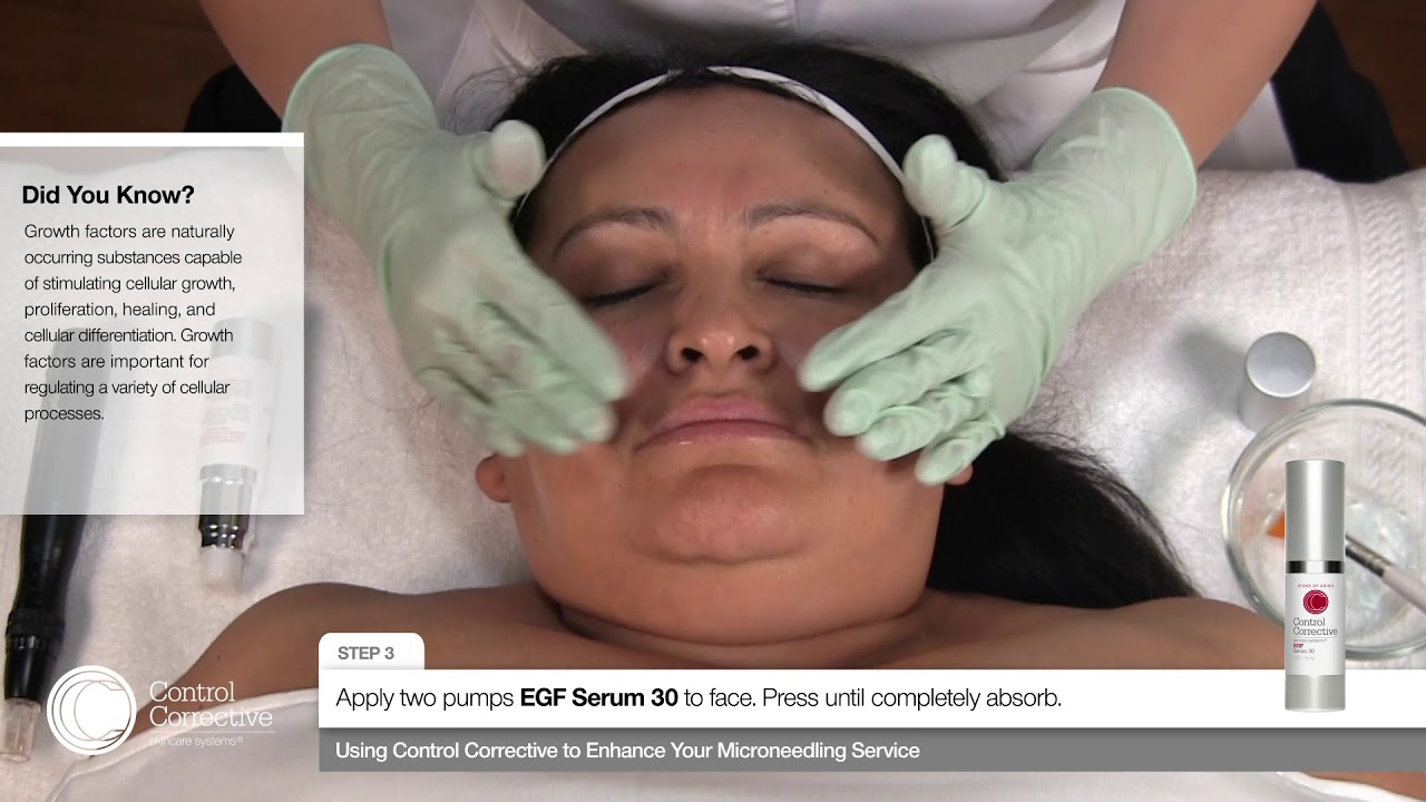Enhance Your Microneedling Service with Control Corrective
