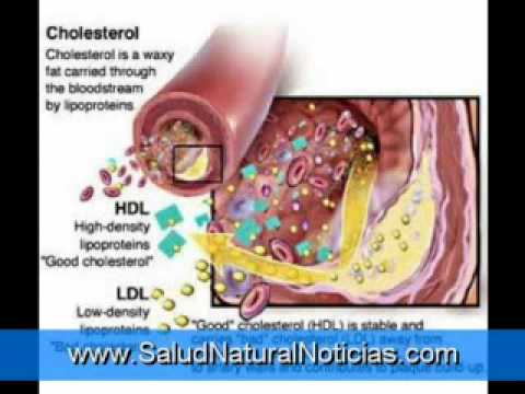 Essere informati che alcuni di prostatite Vezikulita gonecystitis