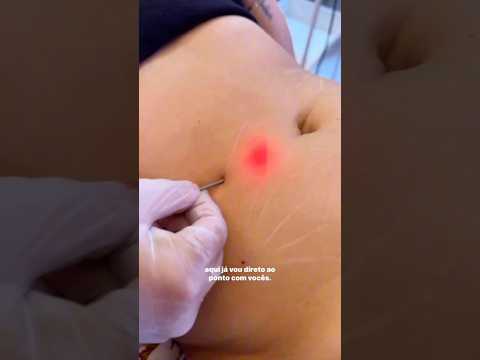 Thumbnail do vídeo 3