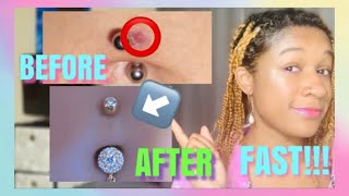 How to get rid of a bump/keloid on belly piercing |REAL Divyne