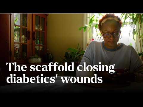 The scaffold closing diabetics’ wounds  - Nature's Building Blocks | BBC StoryWorks