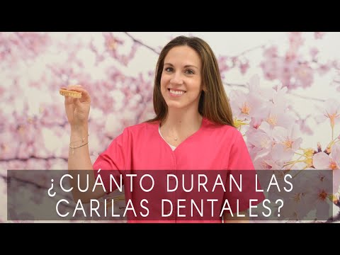 ¿Cuánto duran las carillas dentales?