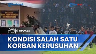 Kondisi Salah Satu Korban Tragedi Kanjuruhan, Masih Kritis dan Dirawat di ICU RSSA