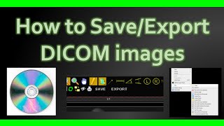 How to Save DICOM images 💿💽🖥️ #howto
