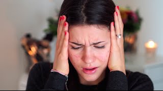 I'M TIRED OF THIS! Acne Doxycycline Theraphy Week 1!