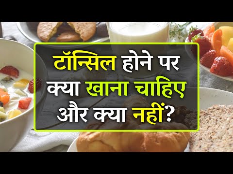 What foods to eat and avoid in tonsillitis