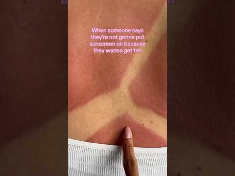 POV: ME REMEMBERING TO PUT ON SUNSCREEN☀️#cocoandeve #sunscreen #spf #sunburn #tanning #summer