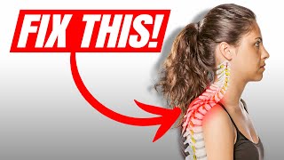The #1 Most Important Muscle To Fix Neck Hump