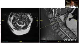 WBOA  PG CRASH COURSE MODULE 'SPINE' 1