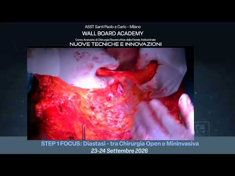 Focus 1 - Live surgery con Federico Fiori: Laparoalloplastica con plastica di riduzione di ampiezza