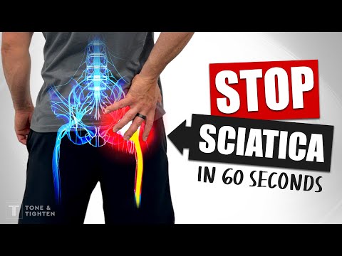 Eliminate Sciatic Nerve Pain FAST - 60-Second Sciatica Relief!
