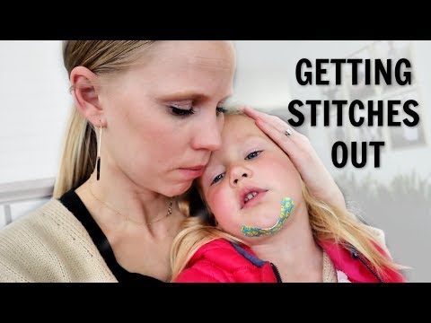 GETTING STITCHES OUT. That didn't go well! Video