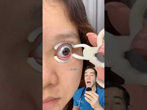 What’s on her eye?!