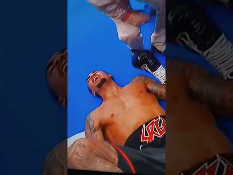 Ben Whittaker! He ALMOST BROKE his NECK!😪🙏🏽 Only his leg broke though. 💪🏽