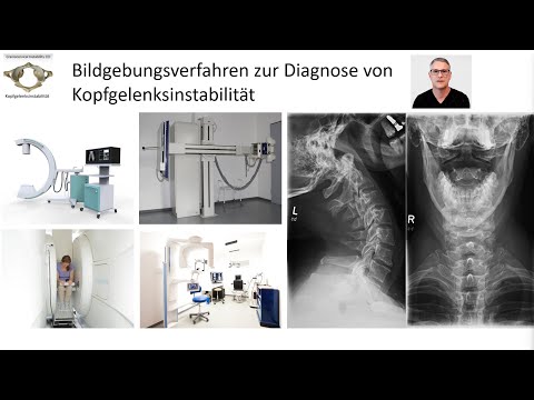 Bildgebungsverfahren zur Diagnose Kopfgelenkesinstabilität