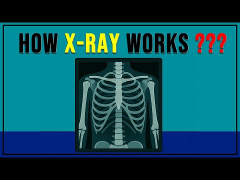 X-Rays Are INVISIBLE! (How Doctors See Through Your Skin 🤯)