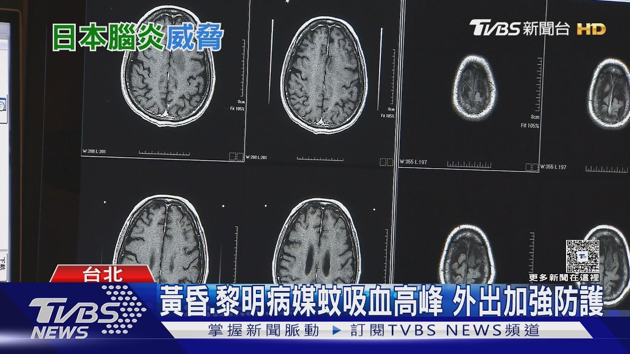 日本腦炎不只威脅幼童！確診以「這年紀」以上成人居多