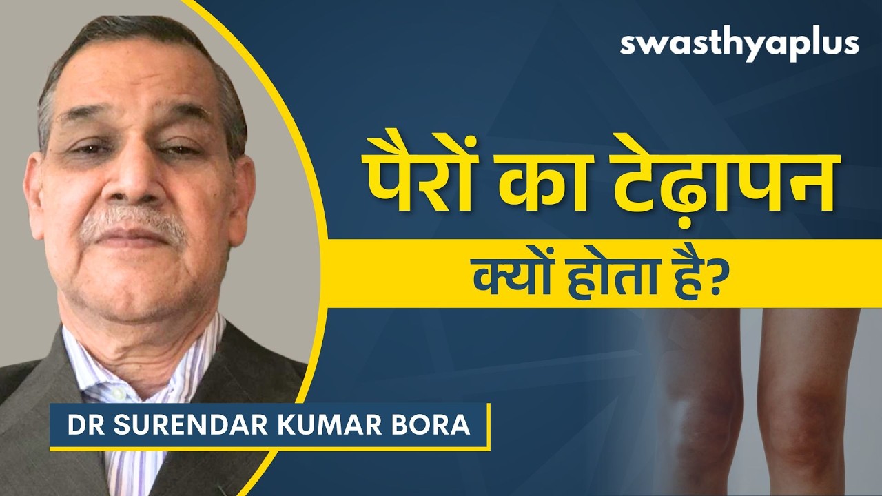 बच्चों और बड़ों में टेढ़े पैर होने के कारण क्या हैं? | Bow
